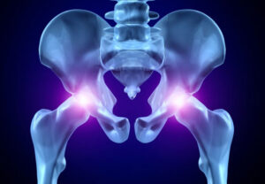 Лечение травмы тазобедренного сустава