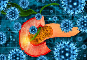 Лечение випомы в Израиле