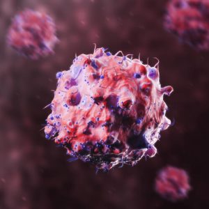 Какие заболевания лечат с помощью IRE NanoKnife
