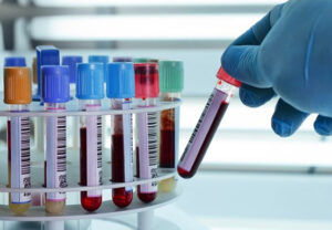 диагностика