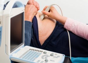 Лечение пупочной грыжи в Израиле