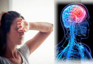 Опухоль головного мозга