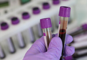 Анализ крови