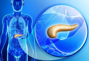 Лечение заболеваний поджелудочной железы в Израиле