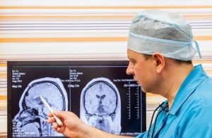 Эпендимома лечение в Израиле