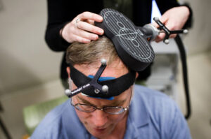 лечение лиссэнцефалии