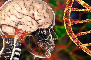 лейкодистрофия