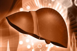 лечение асцита