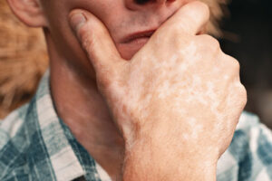 гемохроматоз