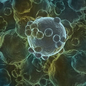 Гемангиобластома