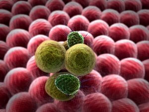 Рак слюнных желез