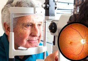 Лечение макулодистрофии в Израиле