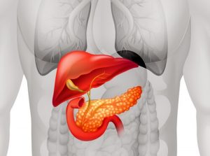 Лечение гемангиомы печени в Израиле.